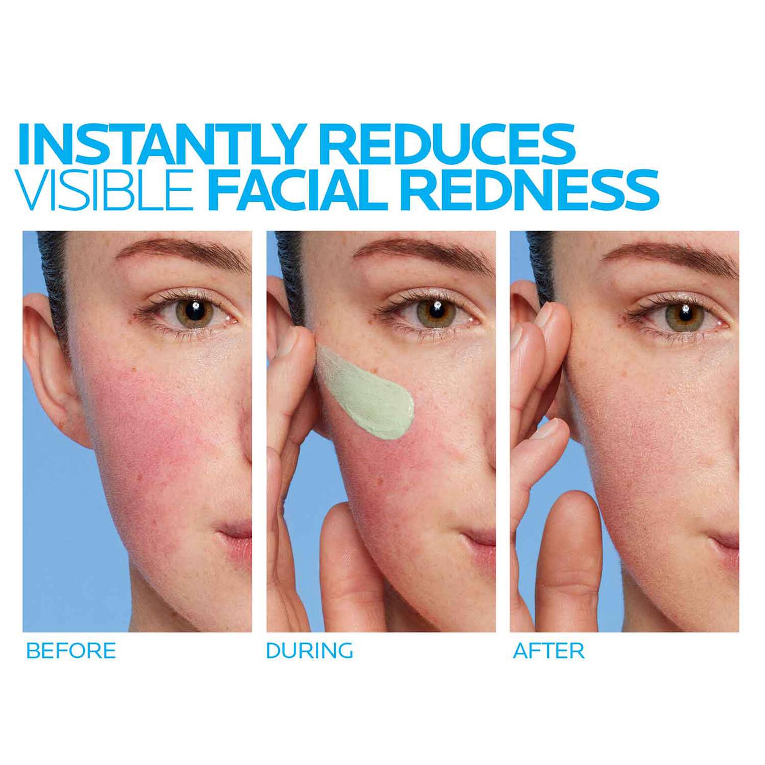toleriane-rosaliac-ar-face-cream-for-visible-redness-y5 8_Toleriane_Rosaliac-AR-before-after.jpg