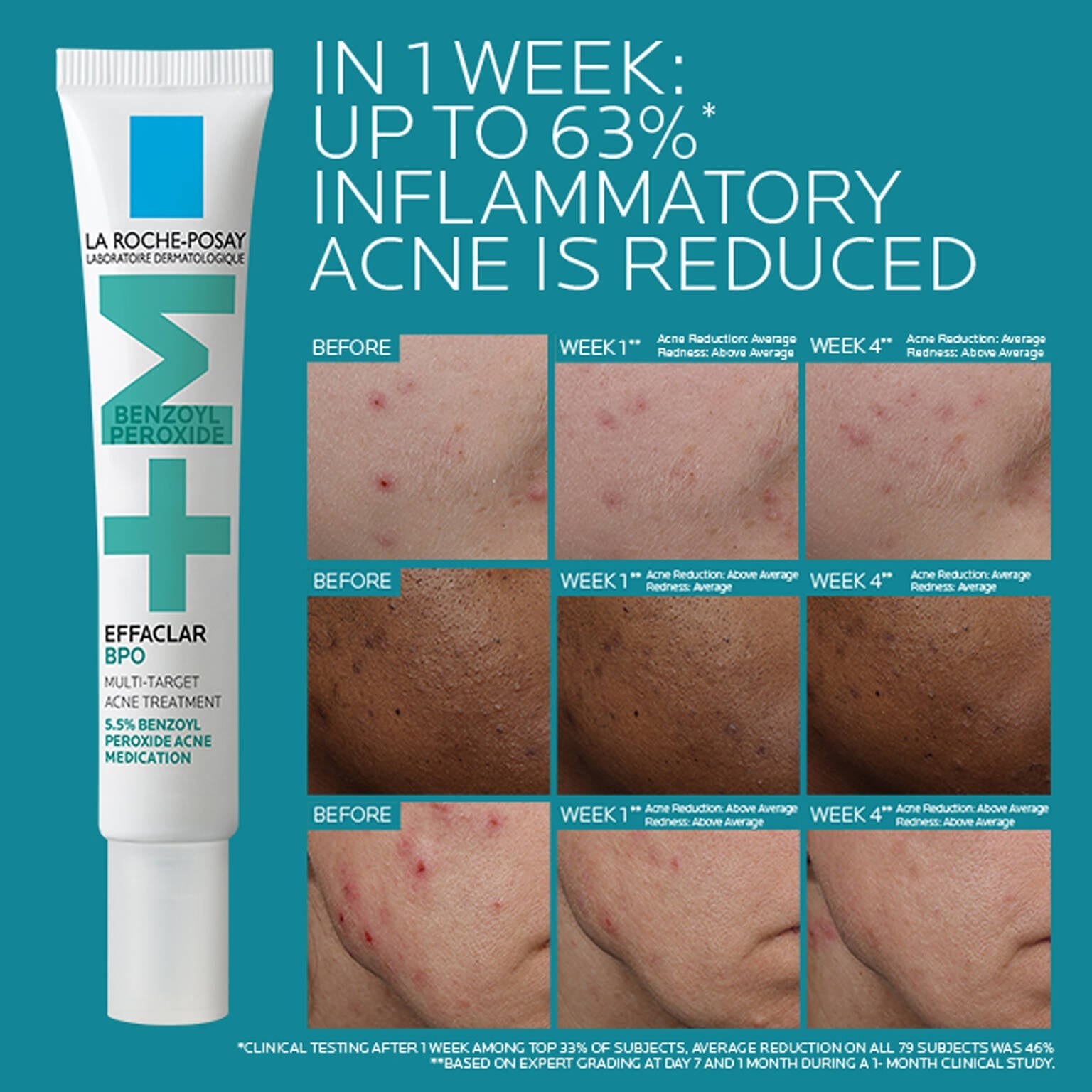 effaclar-bpo-multi-target-acne-treatment-with-5-5-benzoyl-peroxide-u1 EffaclarBPO-ClinicalBA-ATF-1500x1500-2.jpg