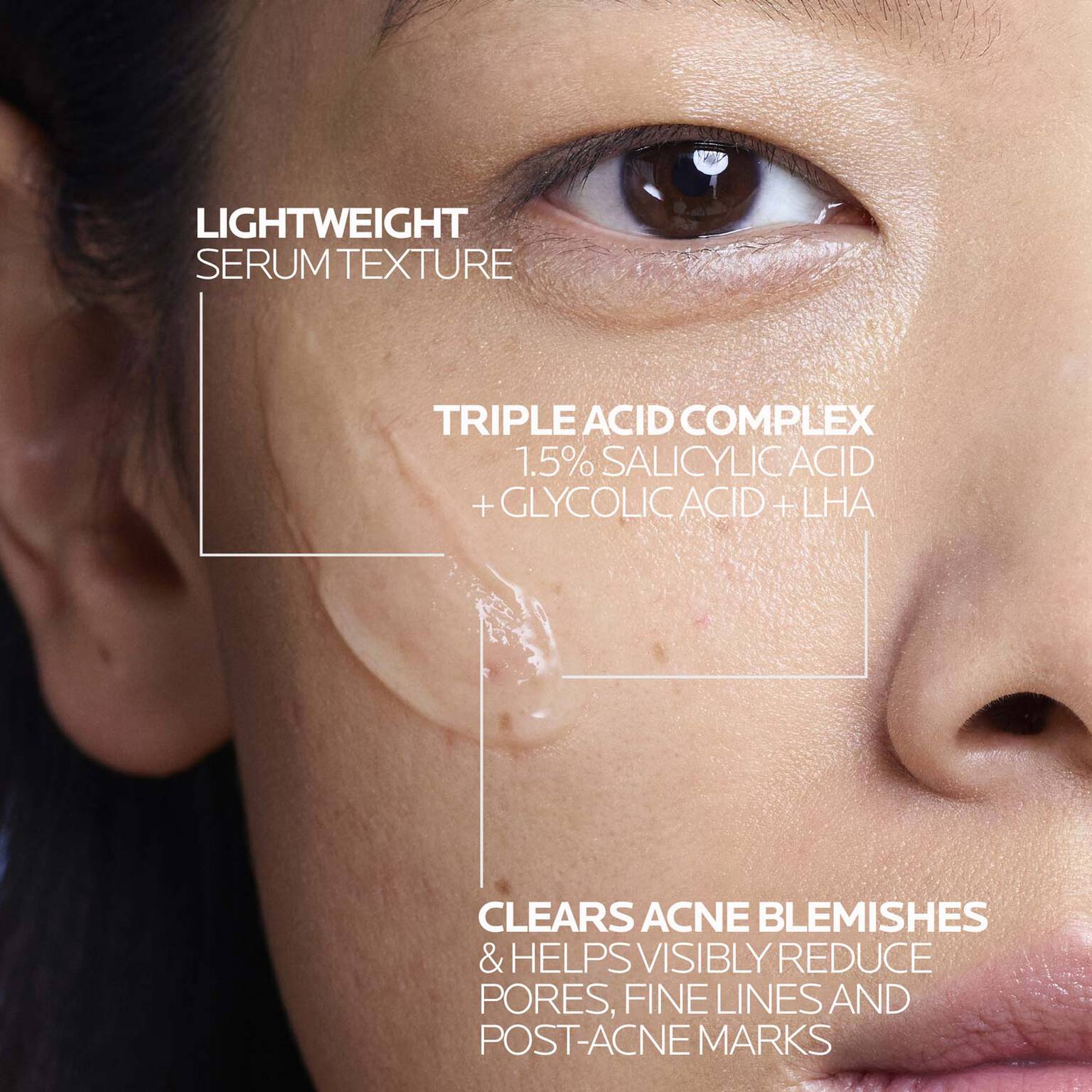 effaclar-salicylic-acid-acne-treatment-serum-c2 LaRochePosay-Product-Effaclar-Effaclar-Serum-30ml-3337875722827-Texture-REV.jpg