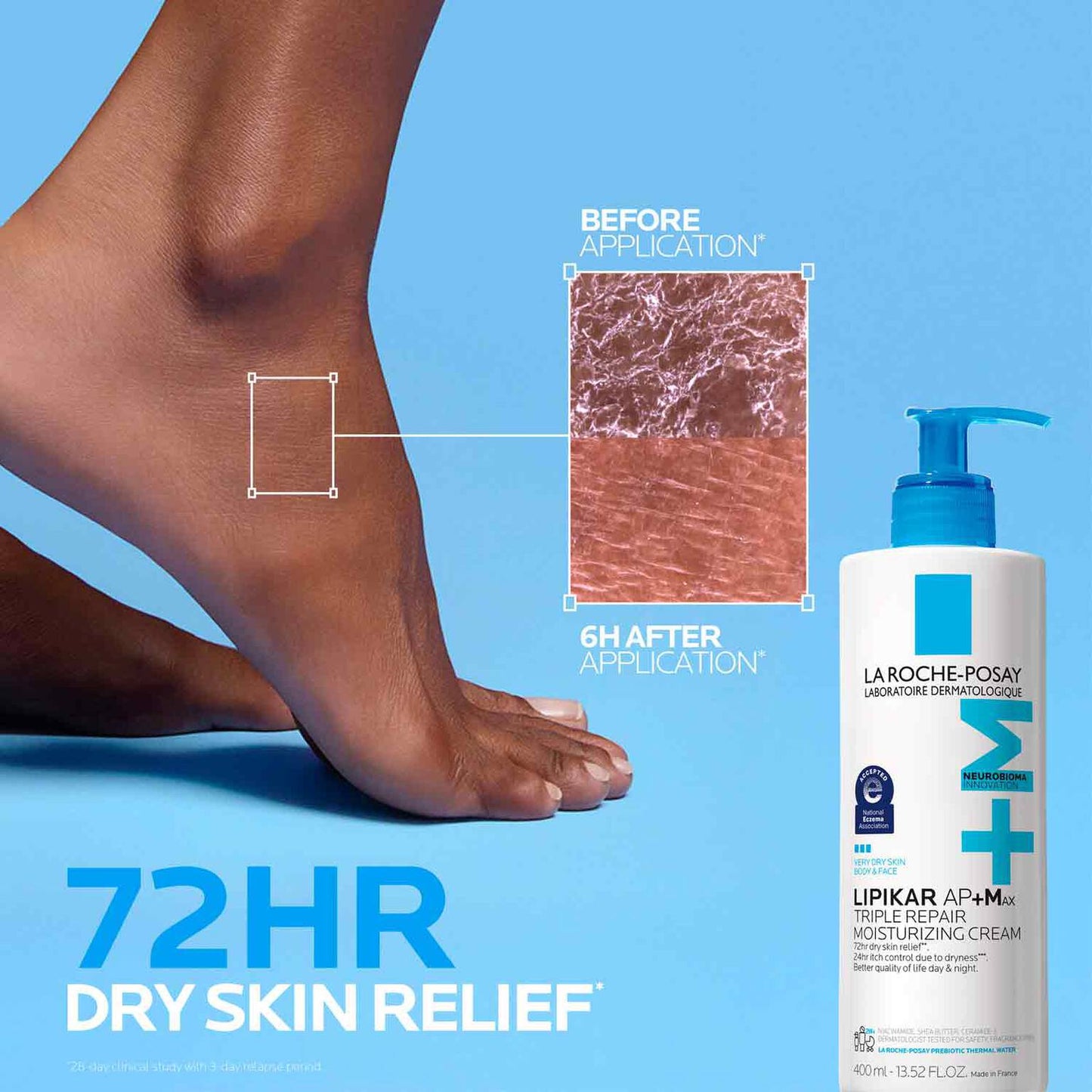 lipikar-ap-max-triple-repair-moisturizing-cream-f8 LaRochePosay-Product-Skincare-Lipikar-Balm-AP+MAX-400ml-3337875941150-ATF-PIM-BeforeAfter.jpg