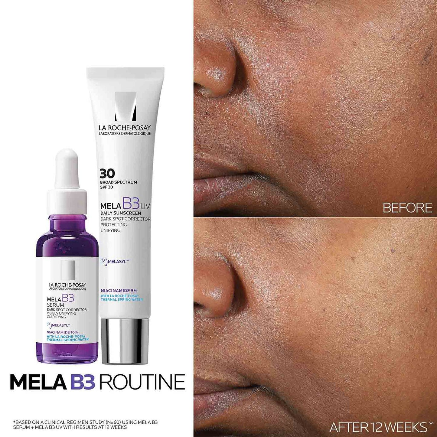 mela-b3-dark-spot-serum-with-melasyltm-niacinamide-p1 Mela-B3-routine_1500X1500.jpg