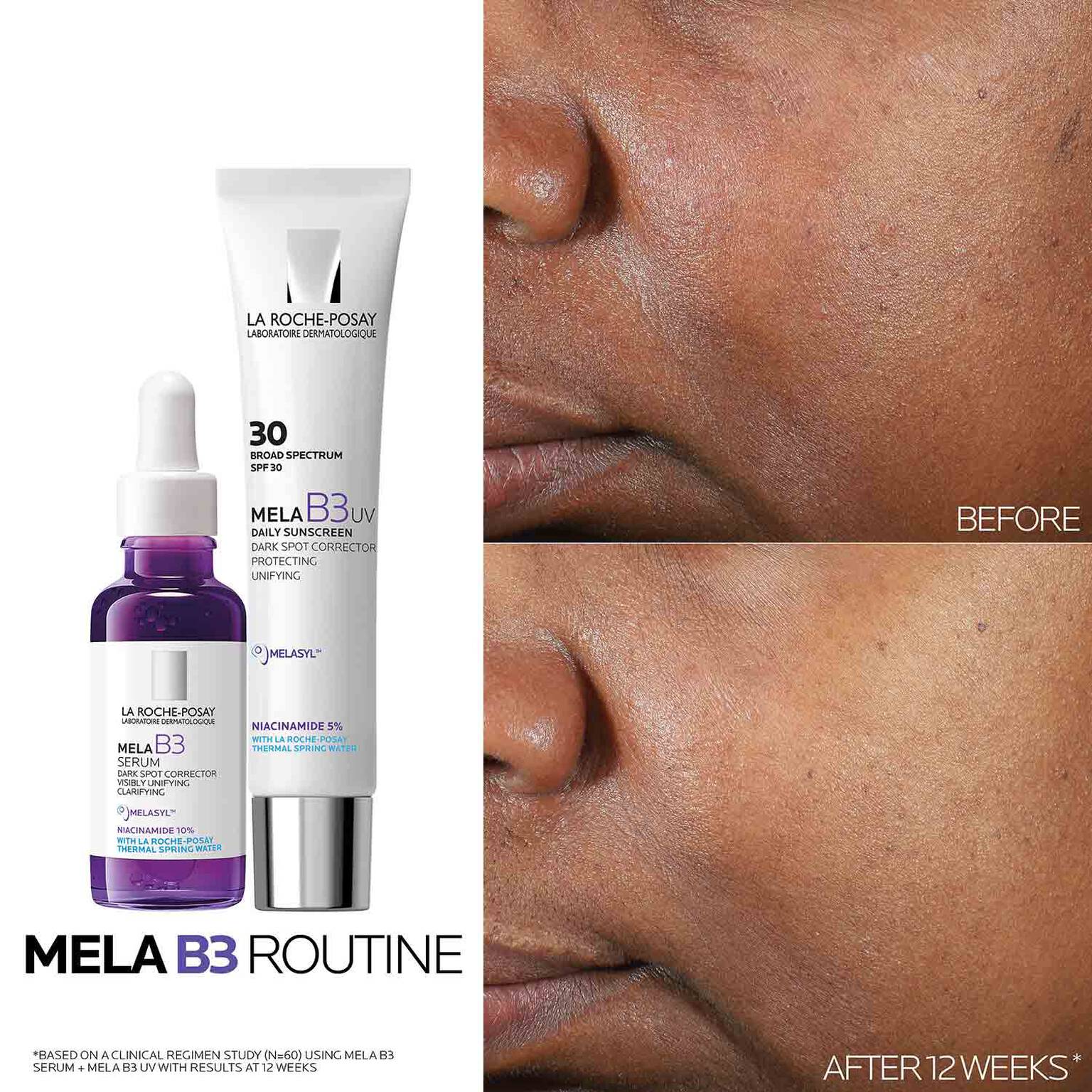 mela-b3-uv-daily-moisturizer-spf-30-with-melasyltm-niacinamide-w9 Mela-B3-routine_1500X1500.jpg